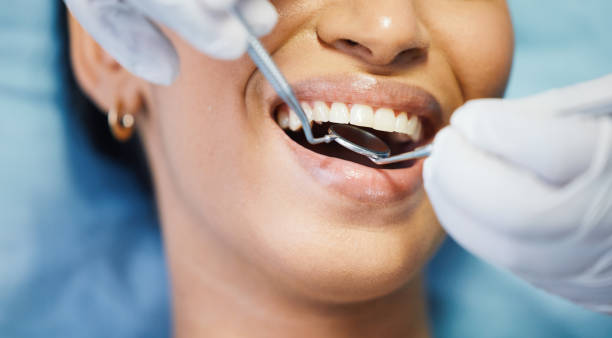 Best Emergency Treatment for Dental Infections or Abscesses in Gypsum, CO